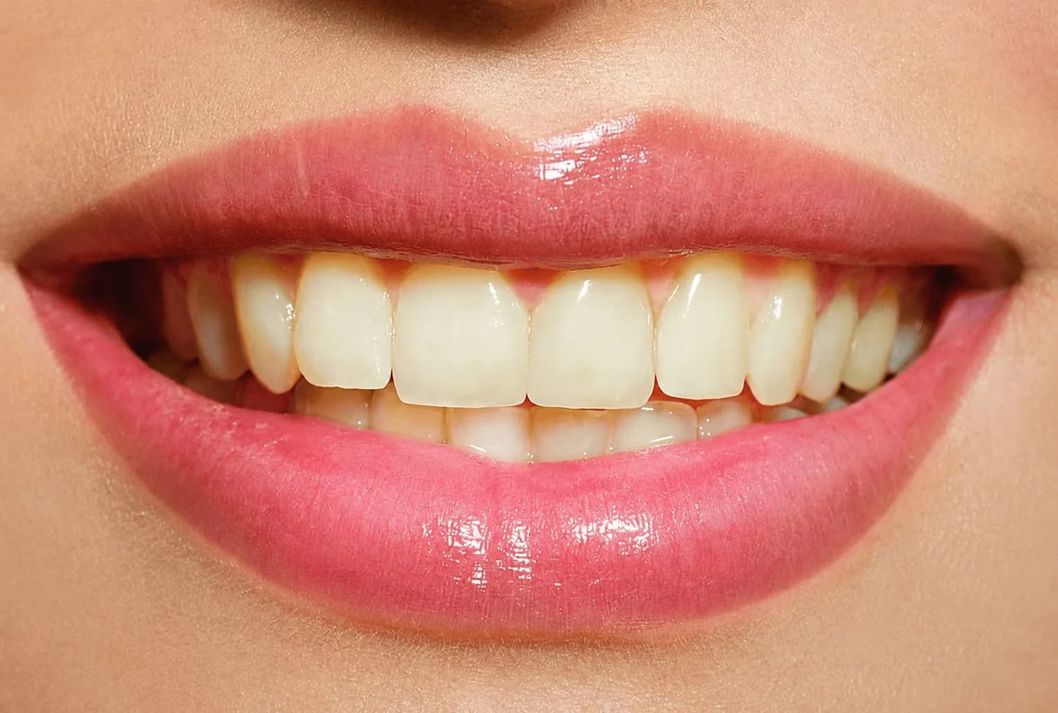Pearl Smile Zahnaufhellung Vorher Aufnahme einer lächelnden Person